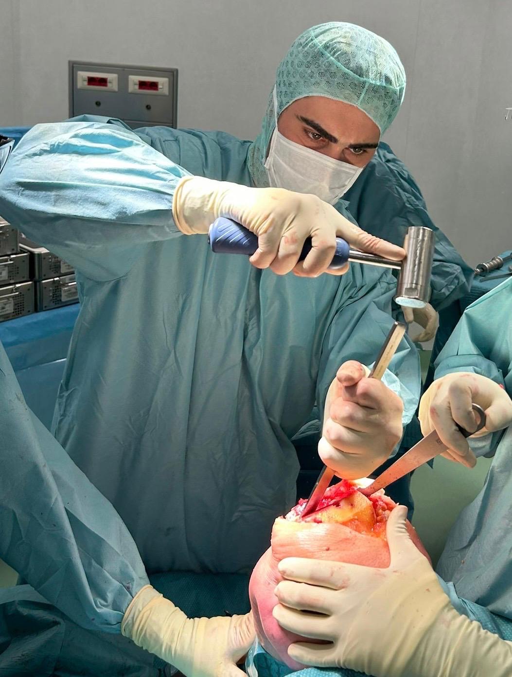 Intervento ortopedico: utilizzo degli strumenti chirurgici